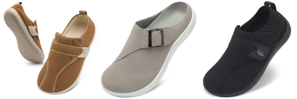 Shoes Swollen Feet combined image